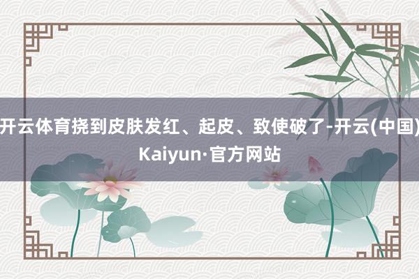 开云体育挠到皮肤发红、起皮、致使破了-开云(中国)Kaiyun·官方网站